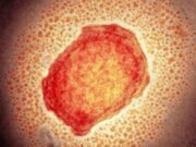 CONFIRMARON EL PRIMER CASO DE VIRUELA DEL MONO EN ARGENTINA.