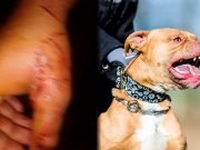 PIDEN SACRIFICAR A UN PERRO PITBULL POR HABERLE ARRANCADO EL BRAZO A UN LADRÓN.