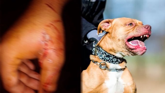 PIDEN SACRIFICAR A UN PERRO PITBULL POR HABERLE ARRANCADO EL BRAZO A UN LADRÓN.