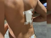 LA CALERA: APUÑALARON A UN JOVEN EN UN BOLICHE.