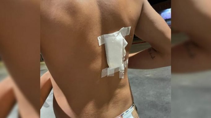 LA CALERA: APUÑALARON A UN JOVEN EN UN BOLICHE.