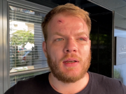 VIOLENCIA QUE NO PARA: ATACARON A GOLPES A UN PERIODISTA A LA SALIDA DEL BOLICHE “ZEBRA” EN CARLOS PAZ. LUEGO LE ROBARON TODO.