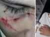 CÓRDOBA VIOLENTA: UNA PATOTA GOLPEÓ Y DESFIGURÓ A UN CHICO A LA SALIDA DE LA ESCUELA.