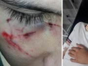 CÓRDOBA VIOLENTA: UNA PATOTA GOLPEÓ Y DESFIGURÓ A UN CHICO A LA SALIDA DE LA ESCUELA.