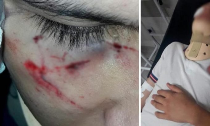 CÓRDOBA VIOLENTA: UNA PATOTA GOLPEÓ Y DESFIGURÓ A UN CHICO A LA SALIDA DE LA ESCUELA.