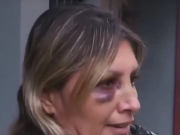 RÍO CUARTO: MOTOCHORROS GOLPEARON A UNA MUJER PARA ROBARLE SU BOLSO.