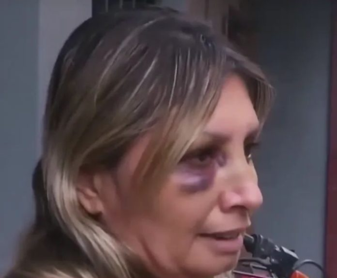 RÍO CUARTO: MOTOCHORROS GOLPEARON A UNA MUJER PARA ROBARLE SU BOLSO.