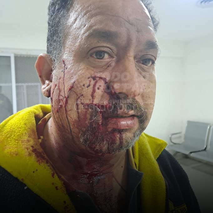 CÓRDOBA: UNA PAREJA ATACÓ A UN TAXISTA PARA ROBARLE. LE CORTARON EL ROSTRO CON EL VIDRIO DE UNA BOTELLA.