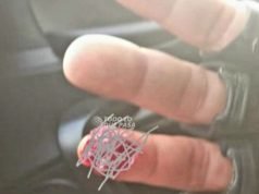 DEÁN FUNES: UN HOMBRE EBRIO LE MORDIÓ LA MANO A UN POLICÍA Y LE ARRANCÓ PARTE DE UN DEDO. SE RESISTÍA A UN CONTROL.