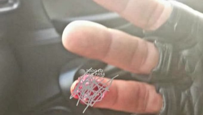 DEÁN FUNES: UN HOMBRE EBRIO LE MORDIÓ LA MANO A UN POLICÍA Y LE ARRANCÓ PARTE DE UN DEDO. SE RESISTÍA A UN CONTROL.