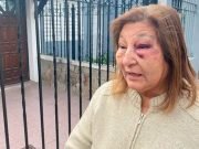 CÓRDOBA: UNA MUJER SE COLGÓ DE LA PUERTA DE SU AUTO PARA EVITAR QUE SE LO ROBEN Y RESULTÓ HERIDA.