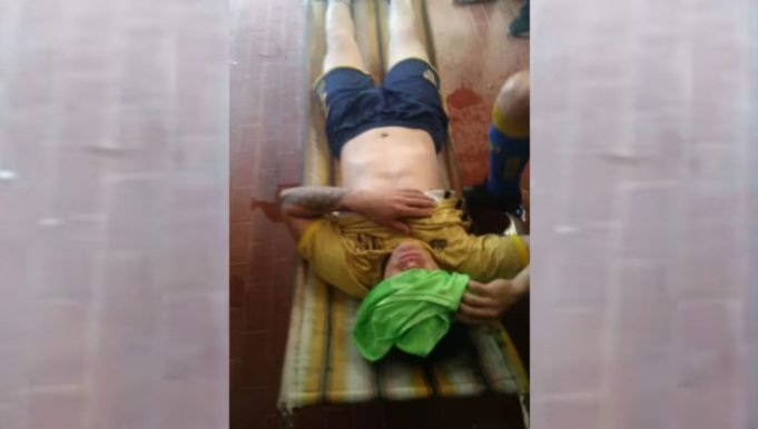 FÚTBOL CALIENTE: LE ARROJARON AGUA HIRVIENDO A UN JUGADOR EN UNA LIGA AMATEUR.