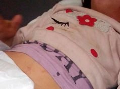 UN PERRO ATACÓ Y ARRASTRÓ A UNA NENA DE 5 AÑOS EN UNQUILLO.