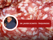 YA SON 6 LOS CASOS DE TRIQUINOSIS EN DEÁN FUNES. ESCUCHÁ LA PALBRA DEL DR. OCANTO.