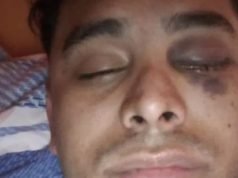LA FALDA: LE HIZO PERDER UN OJO A SU INQUILINO POR DEMORARSE EN EL PAGO DEL ALQUILER.