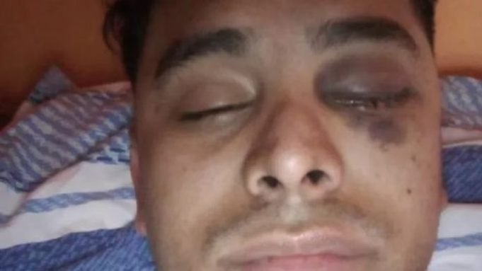 LA FALDA: LE HIZO PERDER UN OJO A SU INQUILINO POR DEMORARSE EN EL PAGO DEL ALQUILER.