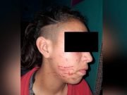 JUAREZ CELMAN: CHICAS ATACARON A GOLPES A UNA ADOLESCENTE Y CORTARON SU CARA CON UNA TRINCHETA.