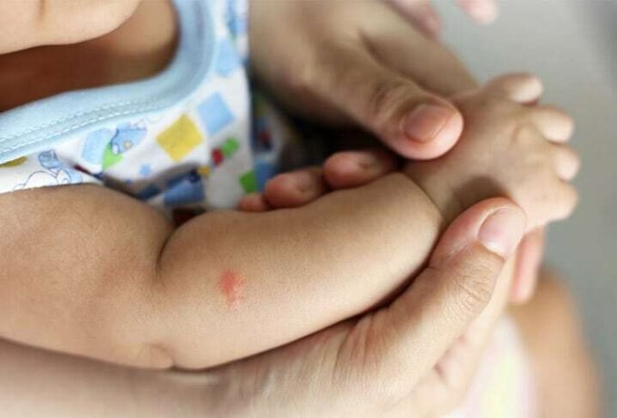 POSADAS: MURIÓ UNA BEBÉ DE 5 MESES POR DENGUE.