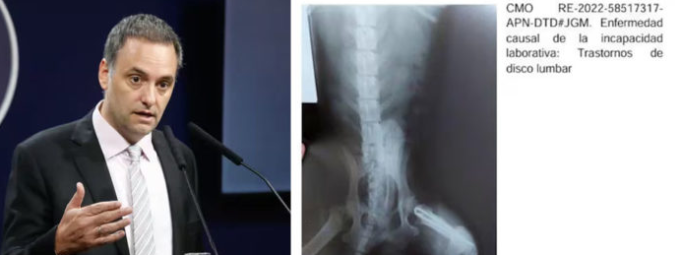 AUDITARÁN MÁS DE 1MILLÓN DE PENSIONES POR DISCAPACIDAD. HAY RADIOGRAFÍAS REPETIDAS Y HASTA LA DE UN PERRO.