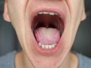 DEÁN FUNES: LANZAN CAMPAÑA DE PREVENCIÓN CONTRA EL CANCER BUCAL.