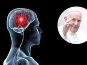 ¿Qué es un ictus? La causa de muerte del Papa Francisco y cómo se relaciona con su deterioro de salud.